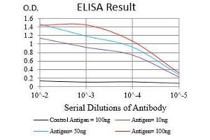 Black line: Control Antigen (100 ng), Purple line: Antigen(10 ng), Blue line: Antigen (50 ng), Red line: Antigen (100 ng), (CA9 抗体  (AA 37-186))
