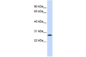 Western Blotting (WB) image for anti-LSM12 Homolog B (LSM12B) antibody (ABIN2459597) (LSM12B 抗体)