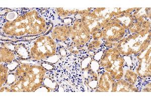 Detection of IL10Rb in Human Kidney Tissue using Polyclonal Antibody to Interleukin 10 Receptor Beta (IL10Rb) (IL10RB 抗体  (AA 87-243))