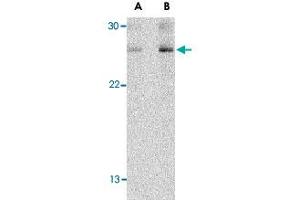 Western blot analysis of TSLP in Jurkat cell lysate with TSLP polyclonal antibody  at (A) 1 and (B) 2 ug/mL . (Thymic Stromal Lymphopoietin 抗体  (C-Term))