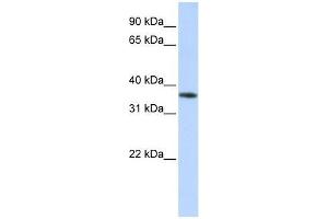 OR13C5 antibody used at 0. (OR13C5 抗体  (Middle Region))
