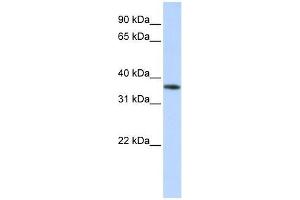 Western Blotting (WB) image for anti-Olfactory Receptor, Family 13, Subfamily C, Member 5 (OR13C5) (Middle Region) antibody (ABIN927329)