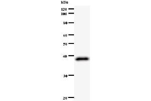 Western Blotting (WB) image for anti-Zw10 Kinetochore Protein (ZW10) antibody (ABIN933128) (ZW10 抗体)