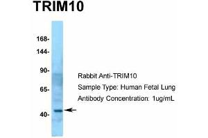Host:  Rabbit  Target Name:  TRIM10  Sample Type:  Human Fetal Lung  Antibody Dilution:  1. (TRIM10 抗体  (C-Term))