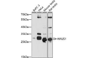 Western blot analysis of extracts of various cell lines, using H antibody (ABIN7267564) at 1:1000 dilution. (HAUS1 抗体  (AA 120-250))