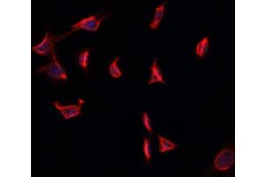 ABIN6274001 staining HepG2 cells by ICC/IF. (CD11b 抗体  (Internal Region))