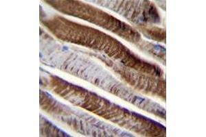 Formalin fixed and paraffin embedded human skeletal muscle reacted with ETFA Antibody (C-term) followed by peroxidase conjugation of the secondary antibody and DAB staining. (ETFA 抗体  (C-Term))
