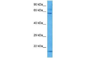 Host:  Mouse  Target Name:  KCNQ1  Sample Tissue:  Mouse Brain  Antibody Dilution:  1ug/ml (KCNQ1 抗体  (N-Term))