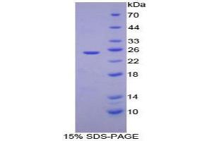 SDS-PAGE analysis of Mouse ADH1 Protein. (ADH1 蛋白)