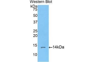 Detection of Recombinant Corin, Rat using Polyclonal Antibody to Corin (CRN) (Corin 抗体  (AA 533-634))