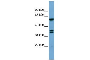 WB Suggested Anti-GRK4 Antibody Titration: 0. (GRK4 抗体  (Middle Region))