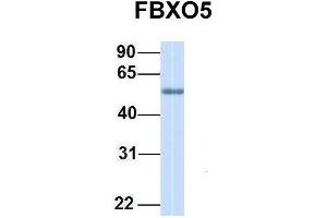 Host:  Rabbit  Target Name:  FBXO5  Sample Type:  Human Adult Placenta  Antibody Dilution:  1. (FBXO5 抗体  (C-Term))