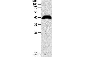 Western blot analysis of Human liver cancer tissue, using OPRL1 Polyclonal Antibody at dilution of 1:1100 (OPRL1 抗体)