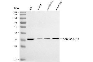 anti-ST6 (Alpha-N-Acetyl-Neuraminyl-2,3-beta-Galactosyl-1,3)-N-Acetylgalactosaminide alpha-2,6-Sialyltransferase 4 (ST6GALNAC4) (AA 39-302) antibody