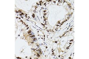 Immunohistochemistry (IHC) image for anti-Deoxycytidine Kinase (DCK) (AA 1-260) antibody (ABIN3022558)
