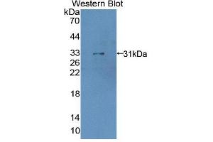 Western blot analysis of the recombinant protein. (LDOC1 抗体  (AA 1-146))