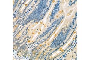 Immunohistochemistry of paraffin embedded mouse small intestine using Znt1 (ABIN7075672) at dilution of 1:650 (300x lens) (SLC30A1 抗体)