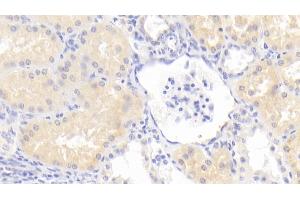 Detection of GM2A in Human Kidney Tissue using Polyclonal Antibody to GM2 Ganglioside Activator (GM2A) (GM2A 抗体  (AA 24-193))