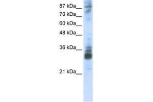 Western Blotting (WB) image for anti-RNA (Guanine-9-) Methyltransferase Domain Containing 2 (RG9MTD2) antibody (ABIN2462341) (RG9MTD2 抗体)