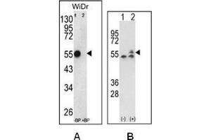 Western Blotting (WB) image for anti-ATP Synthase Subunit beta (AtpB) (AA 142-171), (Middle Region), (Subunit beta) antibody (ABIN453526)