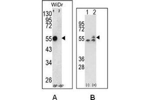 A: Western blot analysis of ATP5B Antibody (Center) Cat. (ATP Synthase Subunit beta (AtpB) (AA 142-171), (Middle Region), (Subunit beta) 抗体)