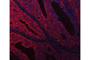 anti-Dedicator of Cytokinesis 1 (DOCK1) (AA 100-1732) antibody