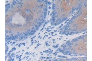 Detection of LRG1 in Mouse Esophagus Tissue using Polyclonal Antibody to Leucine Rich Alpha-2-Glycoprotein 1 (LRG1) (LRG1 抗体  (AA 136-342))