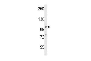 Western Blotting (WB) image for anti-Adaptor-Related Protein Complex 2, alpha 1 Subunit (AP2A1) (AA 706-735), (C-Term) antibody (ABIN657826)