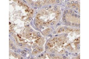 ABIN6266579 at 1/200 staining human kidney tissue sections by IHC-P. (NOS2 抗体  (C-Term))