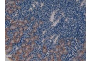 Detection of ATM in Mouse Kidney Tissue using Polyclonal Antibody to Ataxia Telangiectasia Mutated (ATM) (ATM 抗体  (AA 486-742))