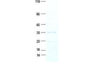 Western Blotting (WB) image for Kinetochore-Localized Astrin/SPAG5 Binding Protein (KNSTRN) (Transcript Variant 3) protein (Myc-DYKDDDDK Tag) (ABIN2718580)