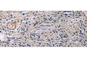 Immunohistochemistry of paraffin-embedded Human brain tissue using SLC30A3 Polyclonal Antibody at dilution of 1:55(x200) (Slc30a3 抗体)