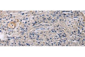 Immunohistochemistry of paraffin-embedded Human brain tissue using SLC30A3 Polyclonal Antibody at dilution of 1:55(x200) (Slc30a3 抗体)