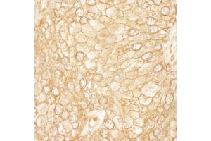 anti-PDZ-RhoGEF (AA 1472-1522) antibody