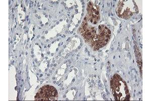 Immunohistochemical staining of paraffin-embedded Human Kidney tissue using anti-GBA3 mouse monoclonal antibody. (GBA3 抗体  (AA 1-150, AA 370-469))