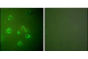 Immunofluorescence analysis of COS7 cells, using GRP78 antibody (ABIN5976417). (GRP78 抗体  (C-Term))
