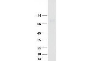 Western Blotting (WB) image for Deltex Homolog 2 (DTX2) (Transcript Variant 1) protein (Myc-DYKDDDDK Tag) (ABIN2719805)
