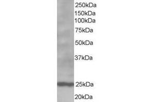 ABIN185269 staining (1µg/ml) of Human Lymph Node lysate (RIPA buffer, 35µg total protein per lane). (Bcl-2 抗体  (N-Term))