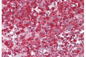 Immunohistochemistry (IHC) image for anti-Profilin 1 (PFN1) (N-Term) antibody (ABIN2783306)