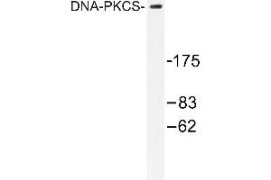 Image no. 2 for anti-Protein Kinase, DNA-Activated, Catalytic Polypeptide (PRKDC) antibody (ABIN265386) (PRKDC 抗体)