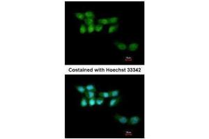 ICC/IF Image Immunofluorescence analysis of paraformaldehyde-fixed A431, using UVSSA antibody [N1N2], N-term , at 1:200 dilution. (UVSSA/KIAA1530 抗体  (N-Term))
