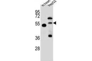 Western Blotting (WB) image for anti-Nitric Oxide Synthase Trafficker (NOSTRIN) antibody (ABIN2997567) (NOSTRIN 抗体)