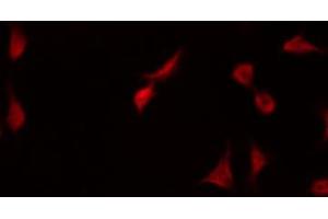 Immunofluorescence (fixed cells) (IF/ICC) image for anti-Forkhead Box O4 (FOXO4) (pSer197) antibody (ABIN6255069)
