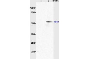Lane 1: mouse embryo lysates Lane 2: mouse brain lysates probed with Anti AVPR2 Polyclonal Antibody, Unconjugated (ABIN705746) at 1:200 in 4 °C. (SLC2A8 抗体  (AA 401-477))