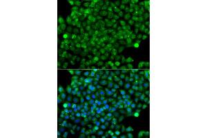 Immunofluorescence analysis of A549 cell using CFHR3 antibody. (CFHR3 抗体)