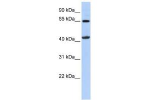 GATM antibody used at 1 ug/ml to detect target protein. (GATM 抗体)