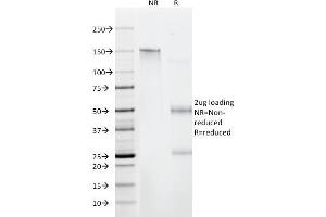 SDS-PAGE Analysis Purified CD6 Mouse Monoclonal Antibody (C6/372). (CD6 抗体)