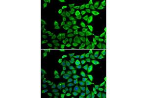 Immunofluorescence analysis of U2OS cells using PPID antibody (ABIN5974177). (PPID 抗体)