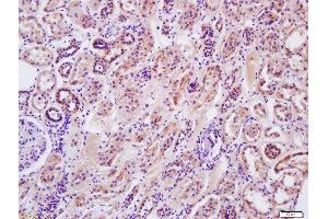 Formalin-fixed and paraffin embedded human kidney labeled with Anti-Arginase II Polyclonal Antibody, Unconjugated  at 1:200 followed by conjugation to the secondary antibody and DAB staining (ARG2 抗体  (AA 181-290))