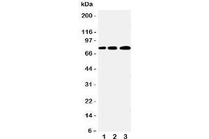 Western blot testing of PLK2 antibody and Lane 1:  A431;  2: 293T;  3: COLO320 cell lysate (PLK2 抗体  (C-Term))